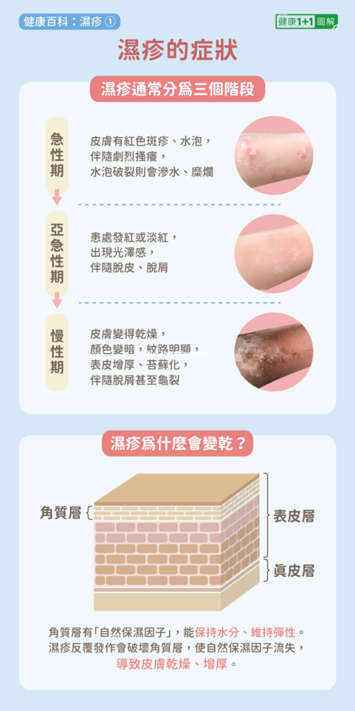 湿疹是这么引起的：深入了解病因和预防策略